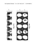 NANOPARTICLES FOR BRAIN TUMOR IMAGING diagram and image