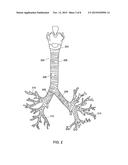 SYSTEM AND METHOD FOR FABRICATING CUSTOM MEDICAL IMPLANT DEVICES diagram and image