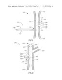 AIRWAY ACCESS DEVICE diagram and image