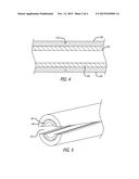 VARIABLE STIFFNESS MULTILAYER CATHETER TUBING diagram and image