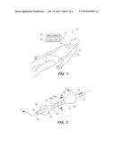 Catheter System for Venous Infusions diagram and image