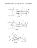 APPARATUS AND METHODS FOR TREATING OBSTRUCTIONS WITHIN BODY LUMENS diagram and image