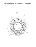 BALLOON CATHETER diagram and image