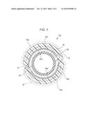 BALLOON CATHETER diagram and image