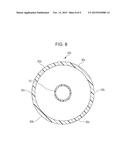 BALLOON CATHETER diagram and image