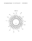 BALLOON CATHETER diagram and image