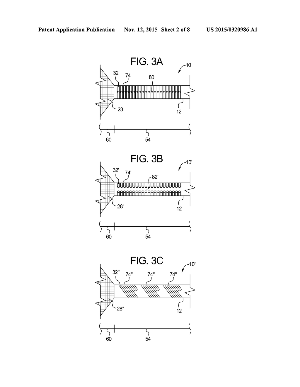 Textile Balloon Catheters - diagram, schematic, and image 03