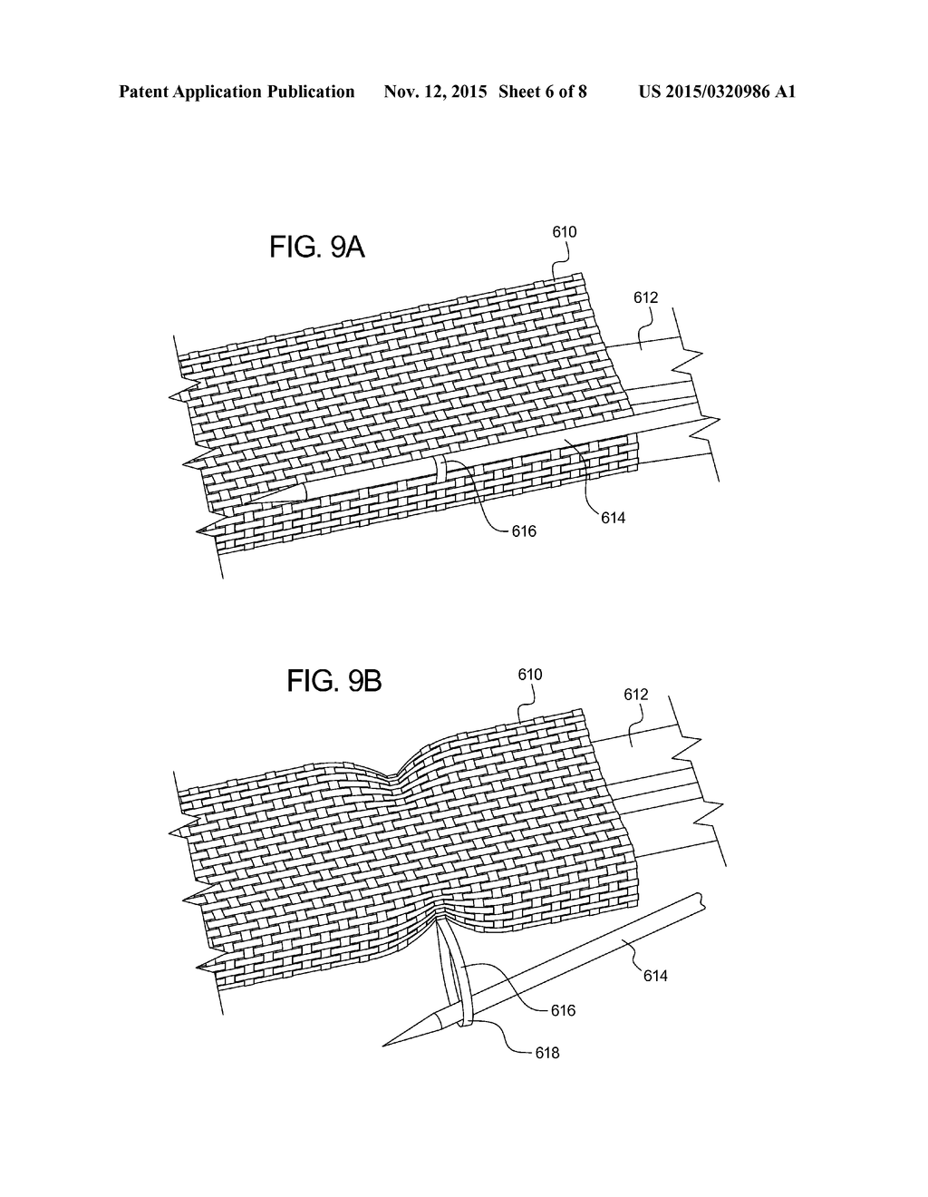 Textile Balloon Catheters - diagram, schematic, and image 07