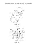 Methods and Systems for Treating Cardiovascular Disease Using an     Implantable Electroacupuncture Device diagram and image