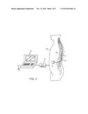 NEUROSTIMULATION SYSTEM WITH THREE-DIMENSIONAL LEAD MIGRATION DETECTION     AND AUTOMATIC NEUROSTIMULATION CORRECTION diagram and image