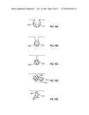 DOSIMETRICALLY CUSTOMIZABLE BRACHYTHERAPY CARRIERS AND METHODS THEREOF IN     THE TREATMENT OF TUMORS diagram and image
