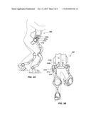 Forward or Rearward Oriented Exoskeleton diagram and image