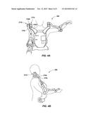 Forward or Rearward Oriented Exoskeleton diagram and image