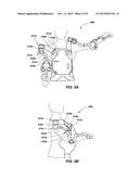 Forward or Rearward Oriented Exoskeleton diagram and image