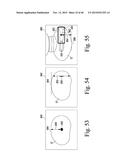 SYSTEM FOR IMAGING AND ORIENTING SEEDS AND METHOD OF USE diagram and image