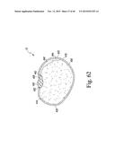 SYSTEM FOR IMAGING AND ORIENTING SEEDS AND METHOD OF USE diagram and image