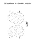 SYSTEM FOR IMAGING AND ORIENTING SEEDS AND METHOD OF USE diagram and image