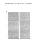 METHOD OF TREATING ADVANCED NON-ALCOHOLIC STEATOHEPATITIS diagram and image