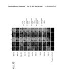 ANTI-SOD1 ANTIBODIES AND USES THEREOF diagram and image