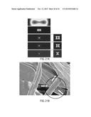 Micro Blood Vessels and Tissue Ducts diagram and image