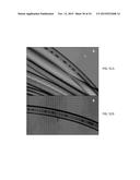 Micro Blood Vessels and Tissue Ducts diagram and image