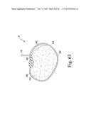 SYSTEM FOR CUTTING AND PREPARING SEEDS AND METHOD OF USE diagram and image