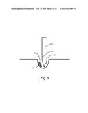 SILICA-BASED BIOLOGICAL MATERIAL ISOLATION diagram and image