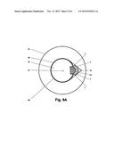 MECHANICAL COUPLING DEVICES diagram and image