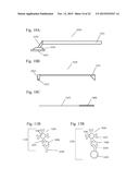 Methods and Devices for Using Mucolytic Agents Including N-Acetyl Cysteine     (NAC) diagram and image