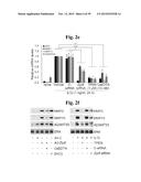 PHARMACEUTICAL COMPOSITIONS COMPRISING INHIBITORS OF ZINC-ZIP8-MTF1 AS     ACTIVE INGREDIENTS FOR PREVENTING OR TREATING A JOINT DISEASE diagram and image