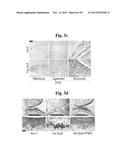 PHARMACEUTICAL COMPOSITIONS COMPRISING INHIBITORS OF ZINC-ZIP8-MTF1 AS     ACTIVE INGREDIENTS FOR PREVENTING OR TREATING A JOINT DISEASE diagram and image