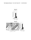 PHARMACEUTICAL COMPOSITIONS COMPRISING INHIBITORS OF ZINC-ZIP8-MTF1 AS     ACTIVE INGREDIENTS FOR PREVENTING OR TREATING A JOINT DISEASE diagram and image