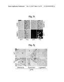 PHARMACEUTICAL COMPOSITIONS COMPRISING INHIBITORS OF ZINC-ZIP8-MTF1 AS     ACTIVE INGREDIENTS FOR PREVENTING OR TREATING A JOINT DISEASE diagram and image