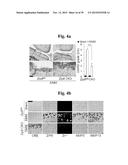 PHARMACEUTICAL COMPOSITIONS COMPRISING INHIBITORS OF ZINC-ZIP8-MTF1 AS     ACTIVE INGREDIENTS FOR PREVENTING OR TREATING A JOINT DISEASE diagram and image