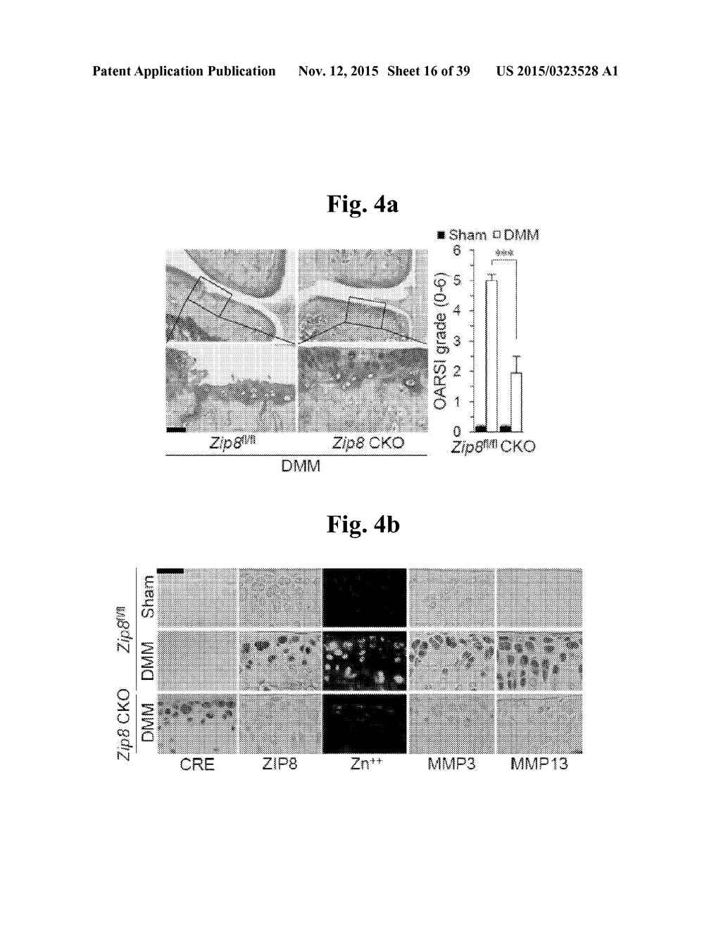 PHARMACEUTICAL COMPOSITIONS COMPRISING INHIBITORS OF ZINC-ZIP8-MTF1 AS     ACTIVE INGREDIENTS FOR PREVENTING OR TREATING A JOINT DISEASE - diagram, schematic, and image 17