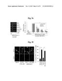 PHARMACEUTICAL COMPOSITIONS COMPRISING INHIBITORS OF ZINC-ZIP8-MTF1 AS     ACTIVE INGREDIENTS FOR PREVENTING OR TREATING A JOINT DISEASE diagram and image