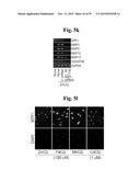 PHARMACEUTICAL COMPOSITIONS COMPRISING INHIBITORS OF ZINC-ZIP8-MTF1 AS     ACTIVE INGREDIENTS FOR PREVENTING OR TREATING A JOINT DISEASE diagram and image