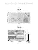 PHARMACEUTICAL COMPOSITIONS COMPRISING INHIBITORS OF ZINC-ZIP8-MTF1 AS     ACTIVE INGREDIENTS FOR PREVENTING OR TREATING A JOINT DISEASE diagram and image