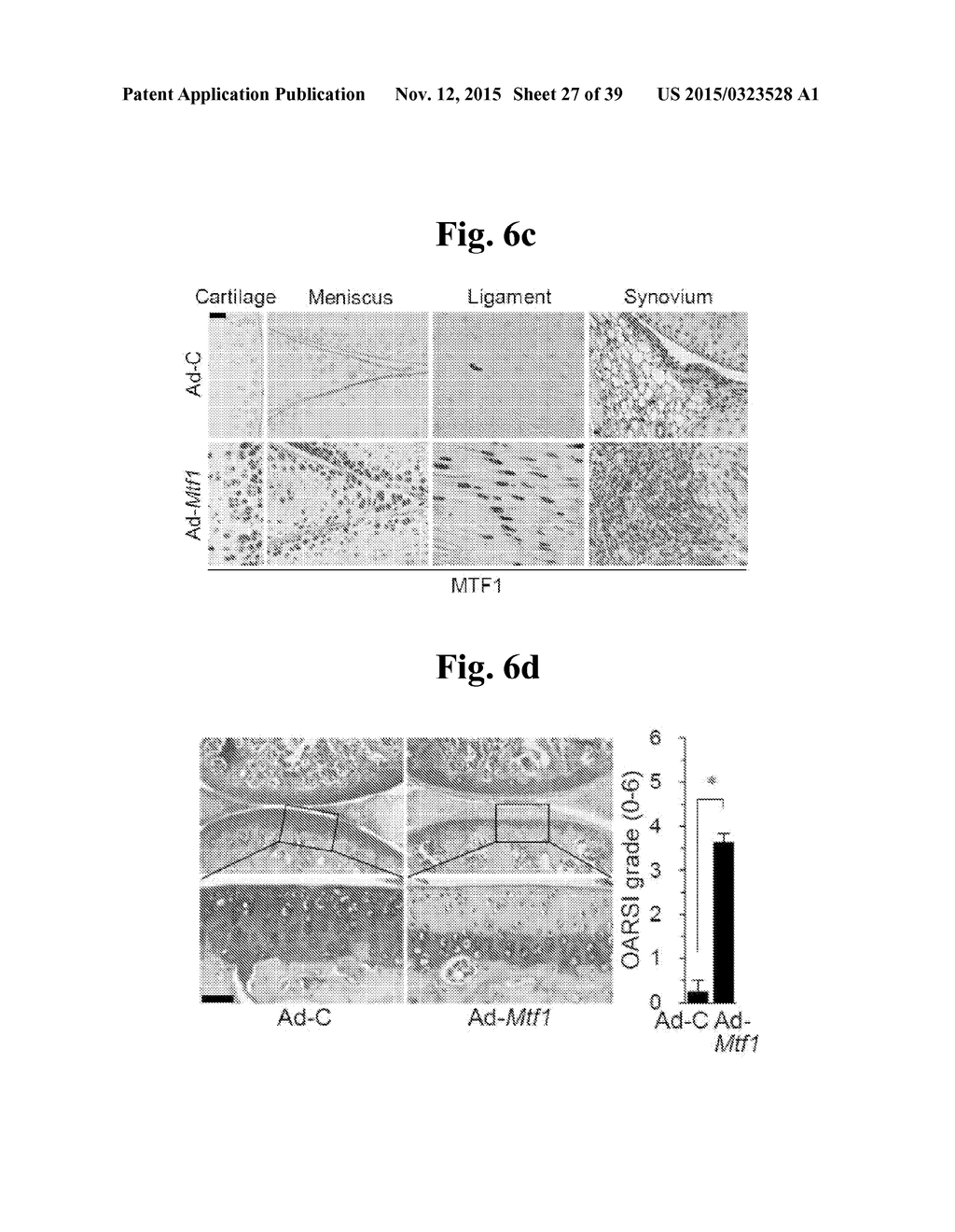 PHARMACEUTICAL COMPOSITIONS COMPRISING INHIBITORS OF ZINC-ZIP8-MTF1 AS     ACTIVE INGREDIENTS FOR PREVENTING OR TREATING A JOINT DISEASE - diagram, schematic, and image 28