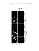 PHARMACEUTICAL COMPOSITIONS COMPRISING INHIBITORS OF ZINC-ZIP8-MTF1 AS     ACTIVE INGREDIENTS FOR PREVENTING OR TREATING A JOINT DISEASE diagram and image