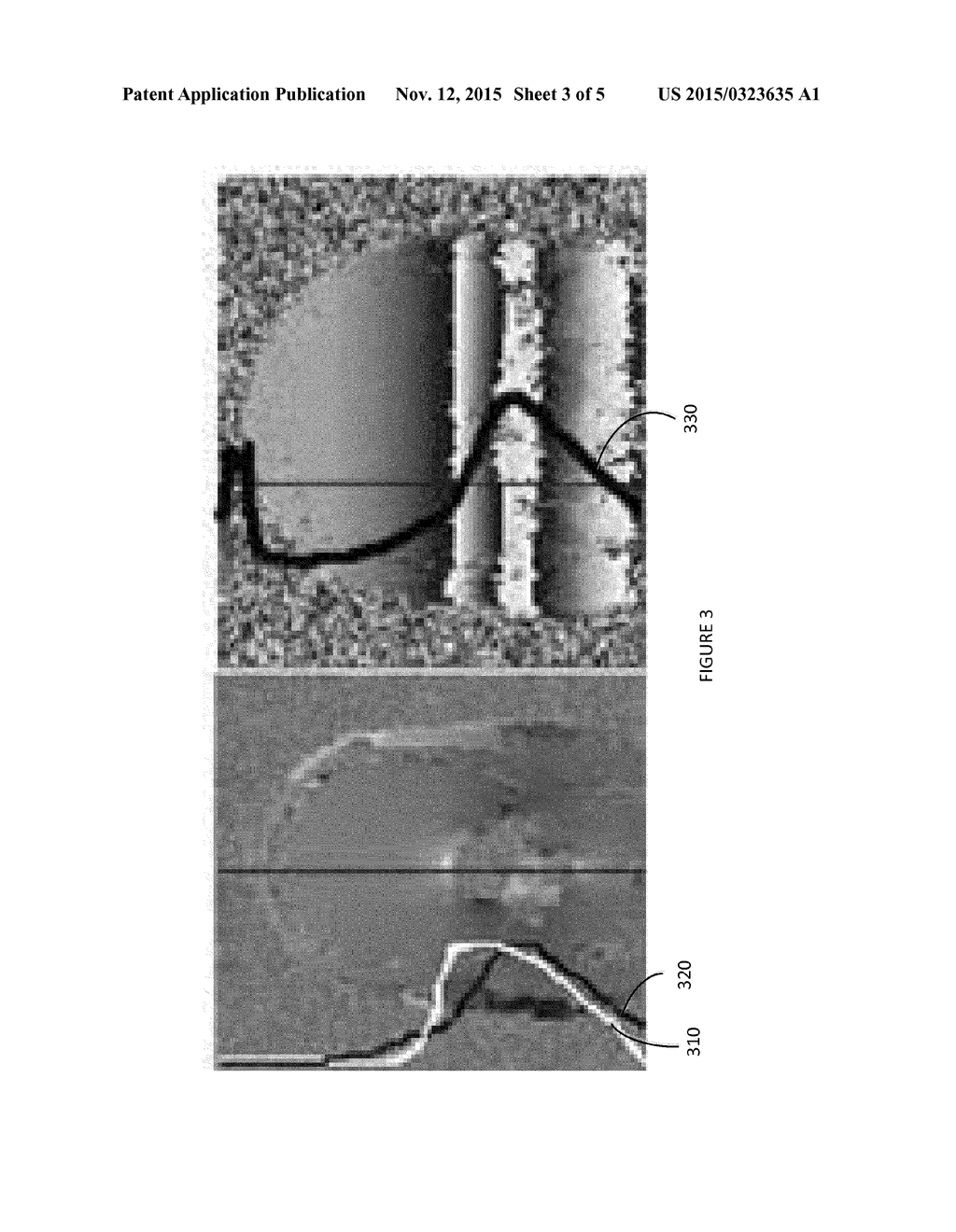 METHOD AND APPARATUS FOR MAGNETIC RESONANCE IMAGING WITH RADIO FREQUENCY     PULSES GENERATED ACCORDING TO PHASE CRITERIA - diagram, schematic, and image 04