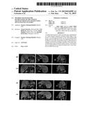 Method and System for Segmentation of the Liver in Magnetic Resonance     Images Using Multi-Channel Features diagram and image