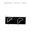 Method and System for Segmentation of the Liver in Magnetic Resonance     Images Using Multi-Channel Features diagram and image