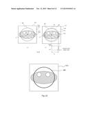 X-RAY CT DEVICE, AND IMAGE RECONFIGURATION METHOD diagram and image