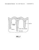 SUPER CONFORMAL METAL PLATING FROM COMPLEXED ELECTROLYTES diagram and image