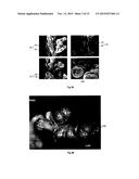 Heat transfer component with dendritic crystal structures and purpose and     method of use for such a component diagram and image