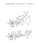 SHOE TREATMENT diagram and image