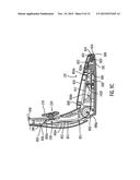 SHOE TREATMENT diagram and image