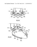 SHOE TREATMENT diagram and image