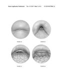 AIRFLOW AND AIRWAY FACTORS diagram and image